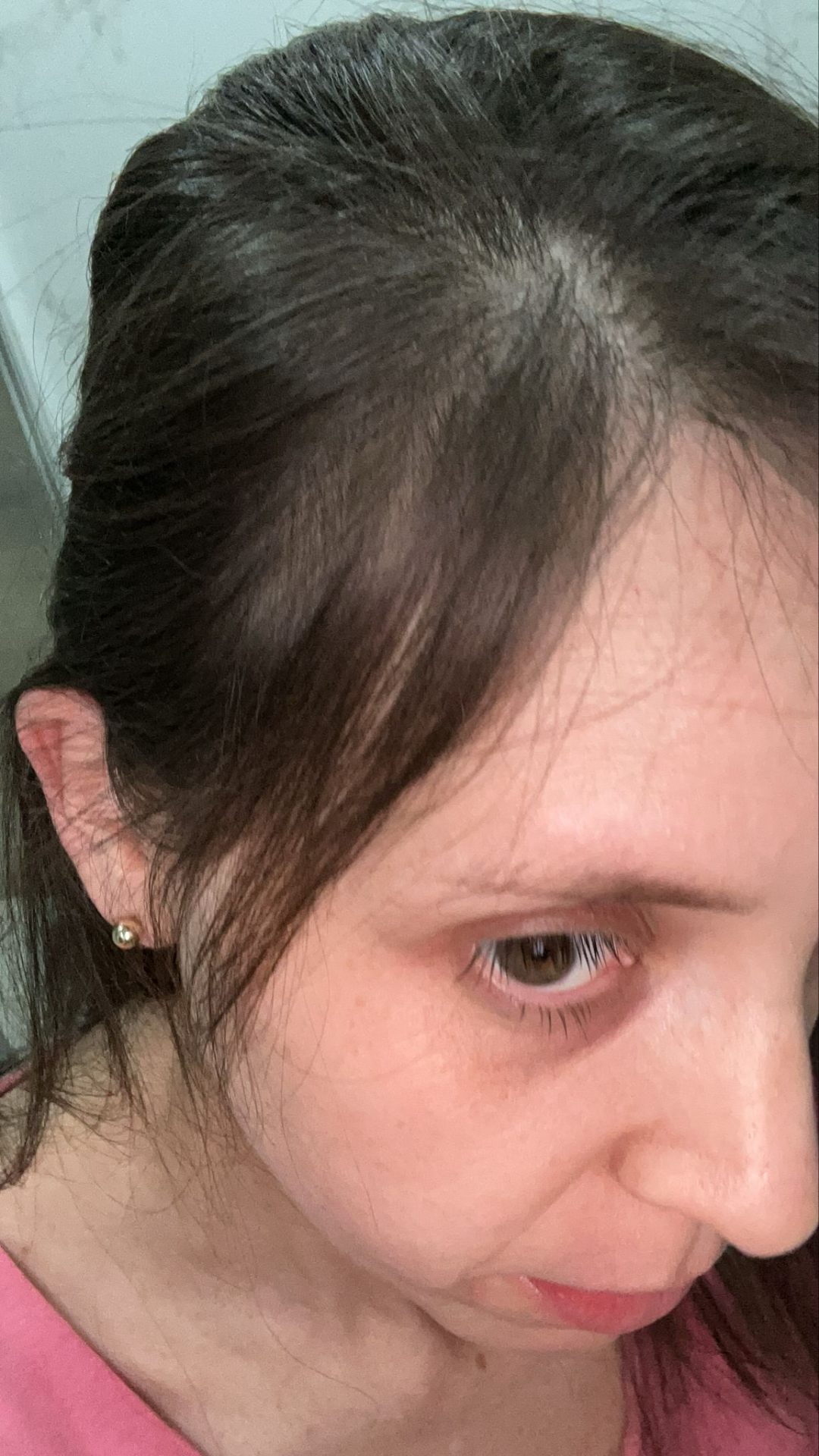 Antes e depois 2 — depois