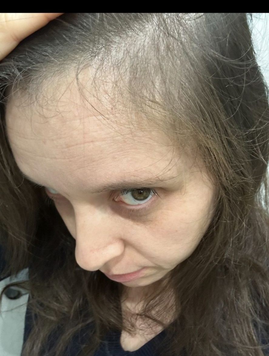 Antes e depois 2 — antes